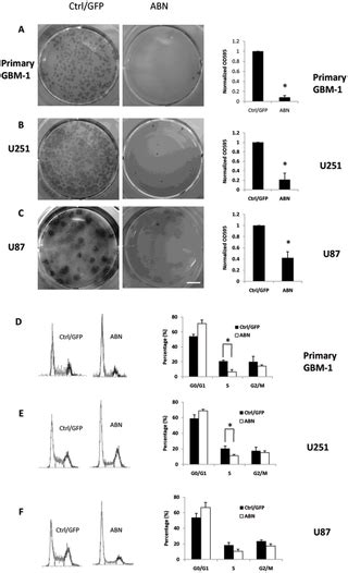 Neuronal Transcription Factors Induce Conversion Of Human Glioma Cells