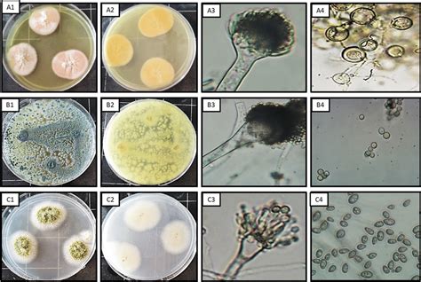 Morphological Identification Of Endophytic Fungal Strains A Nidulans