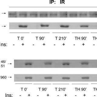 Changes In Insulin Induced Tyrosine Phosphorylation Of Irs After T Or