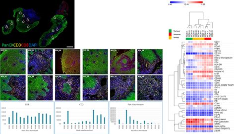 Frontiers Highly Multiplexed Digital Spatial Profiling Of The Tumor Microenvironment Of Head