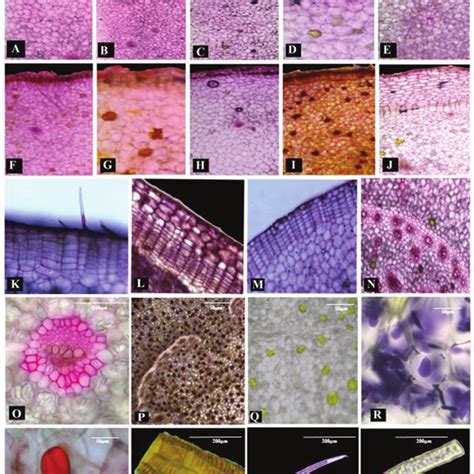 Pdf Morpho Anatomical Characterisation Of The Rhizomes Of Ten Species Of Curcuma L