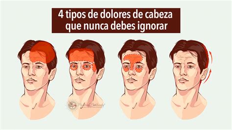 4 Tipos De Dolores De Cabeza Que Nunca Debes Ignorar Conocer Salud