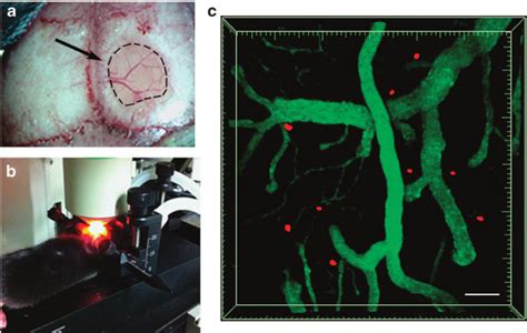 Thinned Skull Preparation And Tplsm Imaging Of The Brain Cortex A