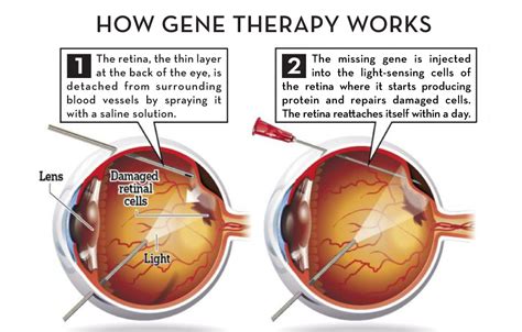 Eye Doctors in Chicago | Expert Service | Village Eyecare