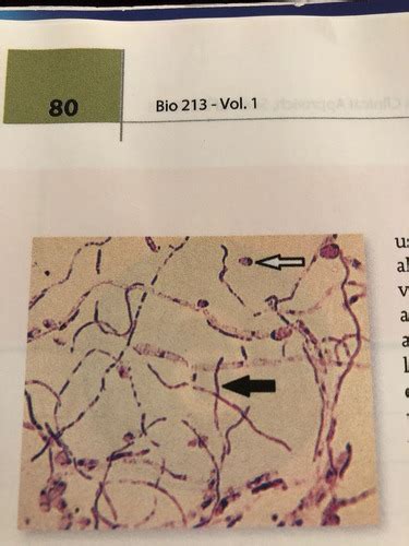 Microbiology Lab Exercise 6 Quiz 3 Flashcards Quizlet