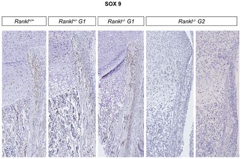 Immunohistochemical Comparative Analysis Of Sox Expression In The