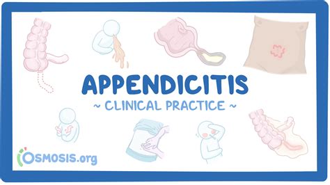 Pathophysiology Of Appendicitis Osmosis Appendicitis Osmosis Ecosdeltorbes