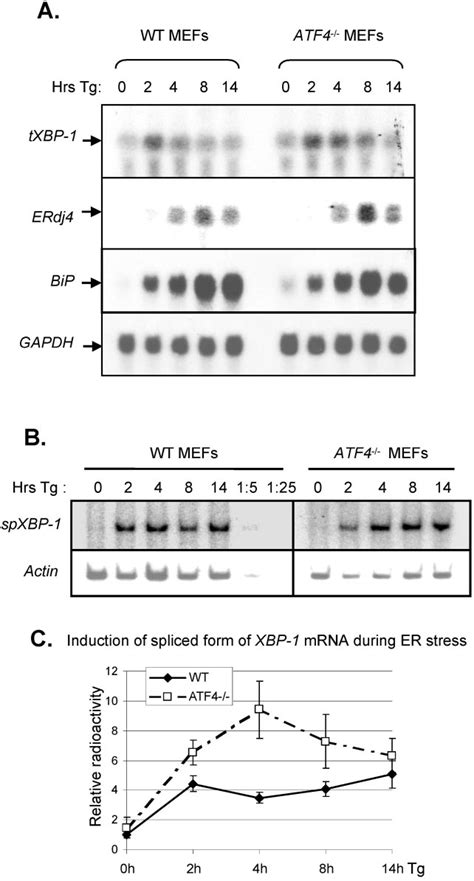 The ATF6 And Ire1 XBP 1 De Pendent Pathway Is Intact In ATF4 Null