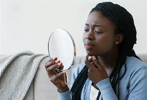 Why Am I Getting Pimples On My Chin? - Okkii.com