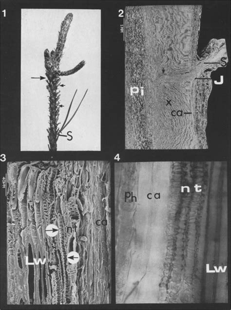 Bright Field Photomicrograph Of Radial Section Of The Cambial Zone Ca