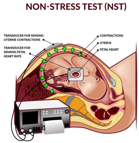 Antepartum Fetal Surveillance