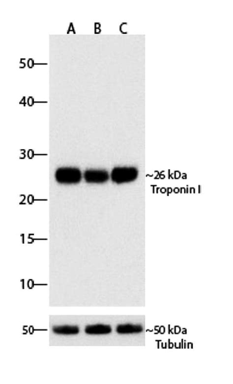 Anti Cardiac Troponin I 抗体 RP23040093 ab313411 アブカム