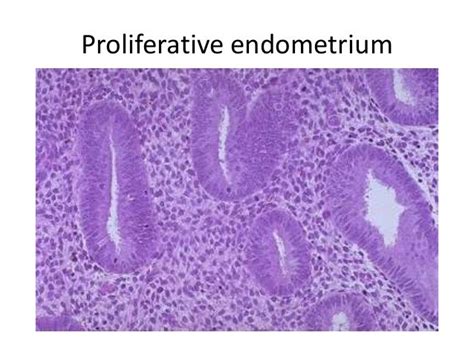 Approach To Endometrial Biopsy