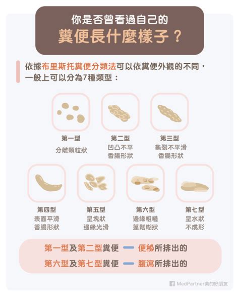 便秘怎麼辦？原因有哪些？醫師圖文完整教學！ 美的好朋友