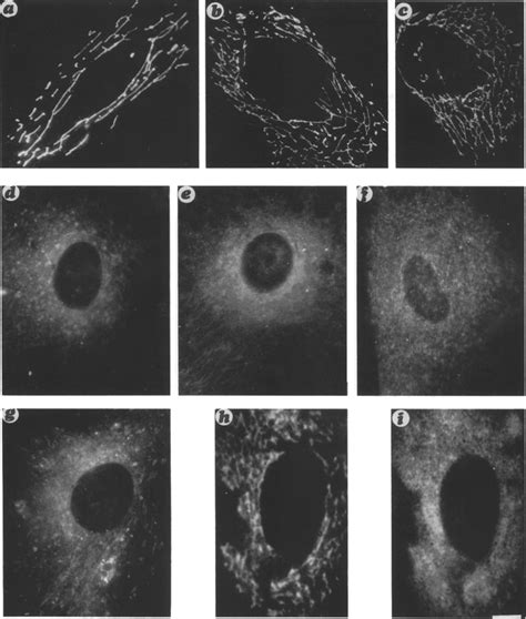 A C Fluorescent Micrographs Showing The Morphology Of The Golgi