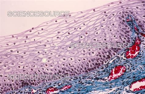 Squamous Epithelium | Stock Image - Science Source Images