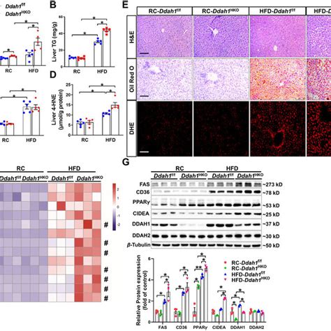 Hepatic Ddah1 Deficiency Aggravated Hepatic Steatosis And Oxidative