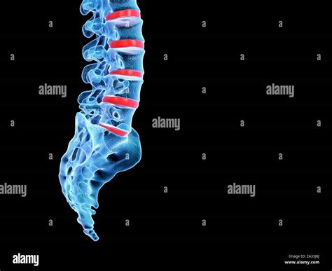 Human Spine Illustration Stock Photo Alamy