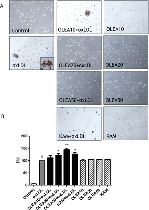 Influence Of Oleacein On Oxldl Induced Foam Cell Formation In