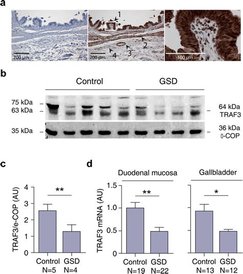 Traf Expression In Human Gallbladder And Duodenal Tissues A