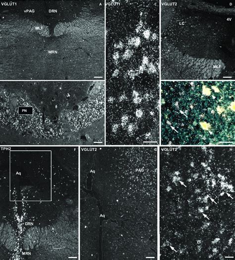 Dark Field ISH Photomicrographs Showing The Distribution Of VGLUT1