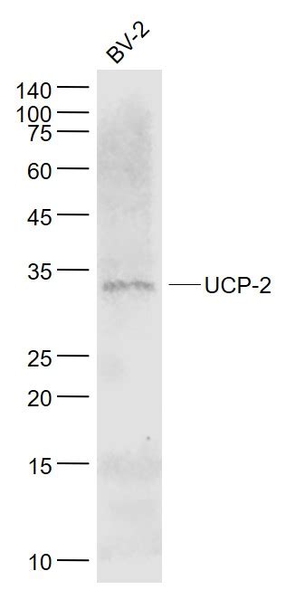 Sample Stomach Mouse Lysate At Ugprimary Anti Ucp Bs R