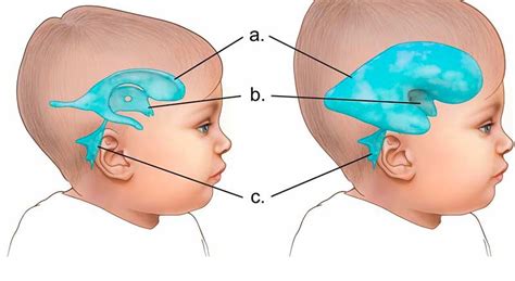 Notícias Cirurgia revolucionária é usada para tratar bebês