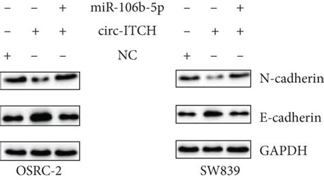 Circ Itch Inhibits Ccrcc Cell Metastasis Via Sponging Mir B P A