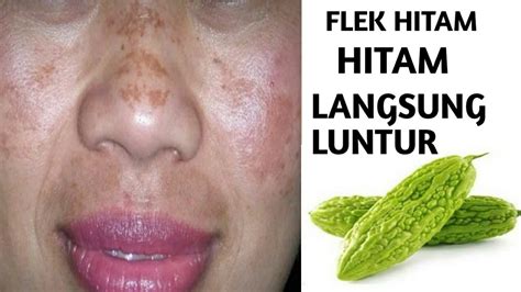 Cara Menghilangkan Flek Hitam Di Wajah Paling Cepat Dan Tepat Sayur