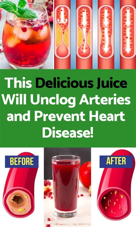 This Delicious Juice Will Unclog Arteries And Prevent Heart Disease