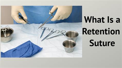 What Is a Retention Suture - YouTube