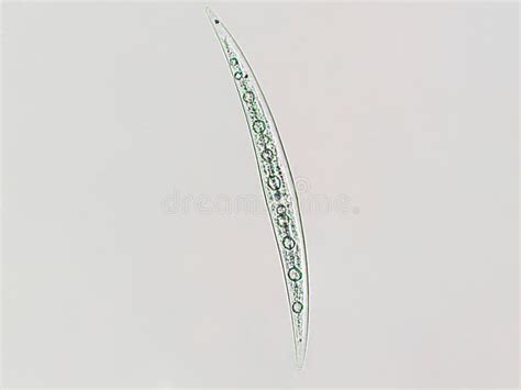 Closterium Sp Algues Charophyta Sous Vue Microscopique X Algues