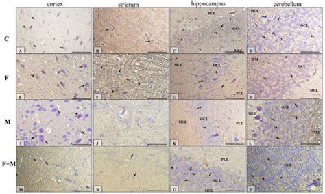 Ijms Free Full Text Fluoride Affects Dopamine Metabolism And Causes