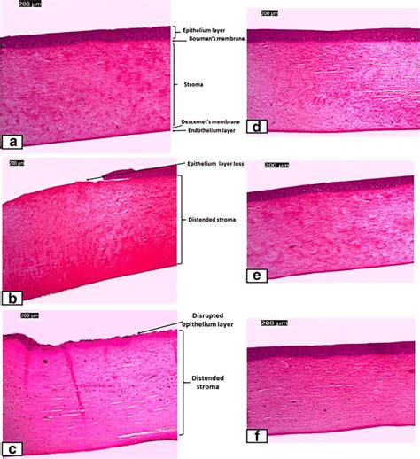 Photomicrographs Of H E Stained Corneal Sections Of A Normal Cornea