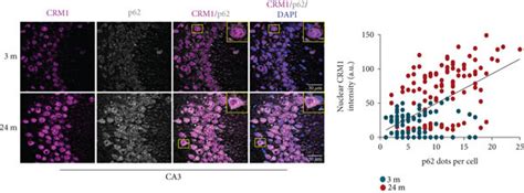 Accumulation Of P62sqstm1 Correlated With High Nuclear Level Of Crm1