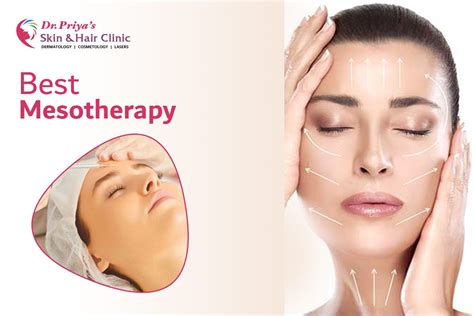 When Should You Opt For Mesotherapy By Dr Priya Skin And Hair