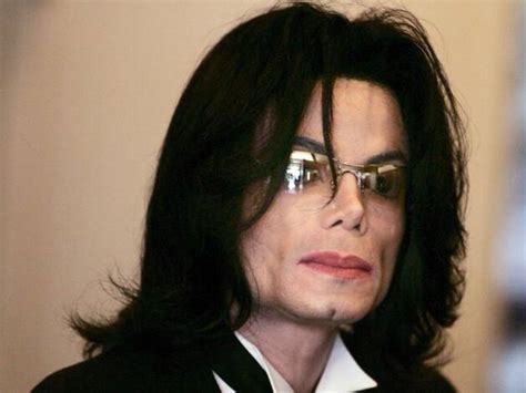 5 Celebrities Who Have Vitiligo | All the BUZZ