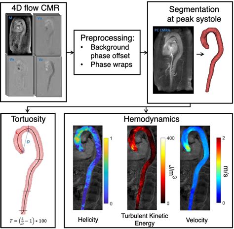 Methods Workflow After Preprocessing Of D Flow Mri Images The Whole