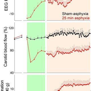 Changes In EEG Power Top Panel Carotid Blood Flow Index Of Cerebral