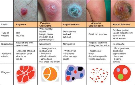 Skin Lesions Causes