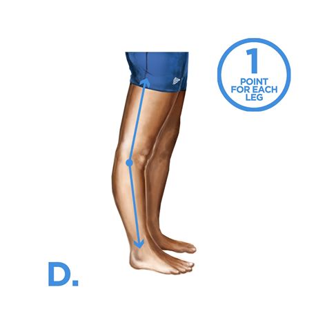 Assessing Joint Hypermobility The Ehlers Danlos Society