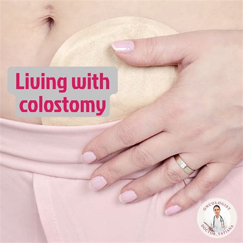 Living With Colostomy Explanation And Recommendations