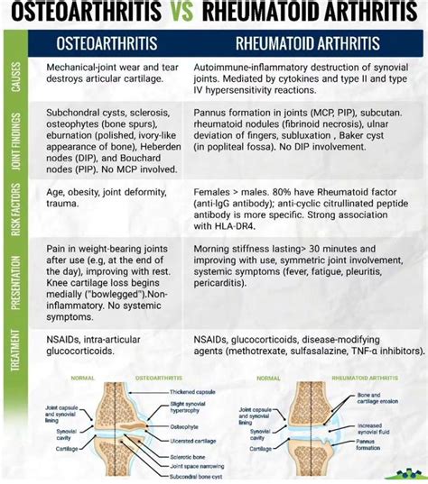 Osteoarthritis Vs Rheumatoid Arthritis MEDizzy