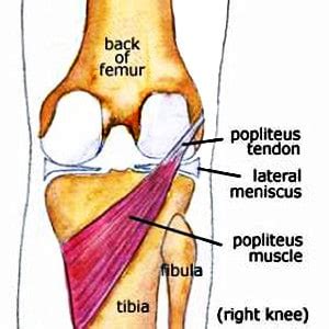 Popliteus Tendinitis Causes with Relief Tips - Pro Knee Pain Relief