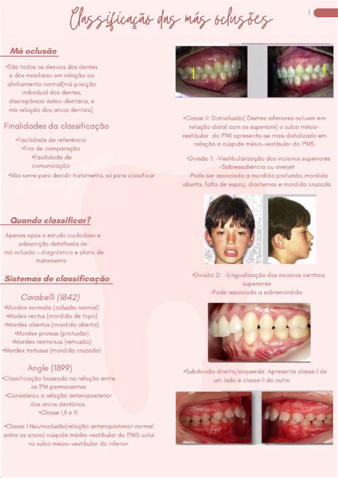 Classificacao Das Mas Oclusoes Ortodontia