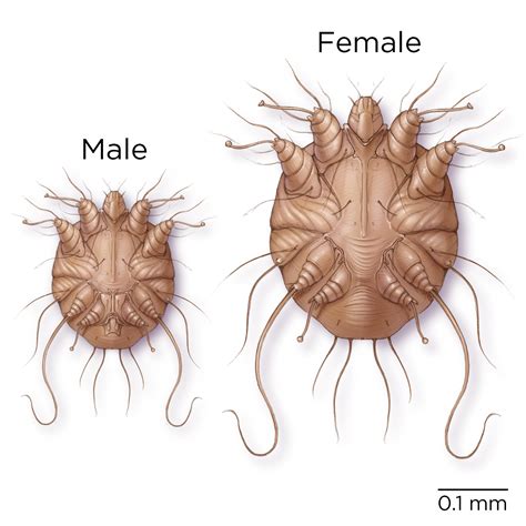 Question 1 Scabies Question Bank National Std Curriculum