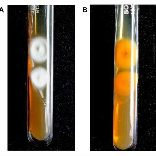 Microscopic Examination Of LPCB Stained Dermatophyte Identified As