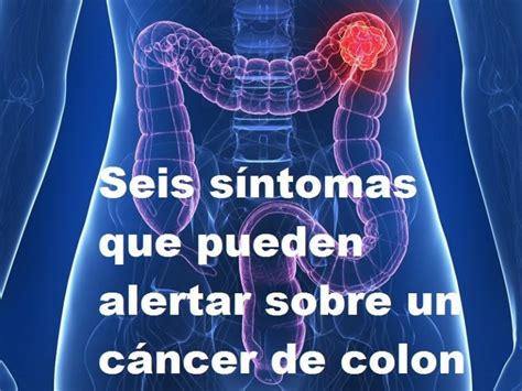 S Ntomas De C Ncer De Colon Prevenci N Y Tratamiento