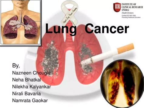 Ppt Lung Cancer Powerpoint Presentation Free Download Id 5790401