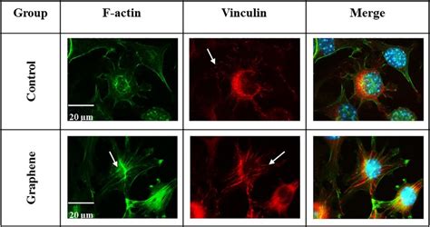 The Architecture Of Actin Cytoskeleton And Focal Adhesion Structures In